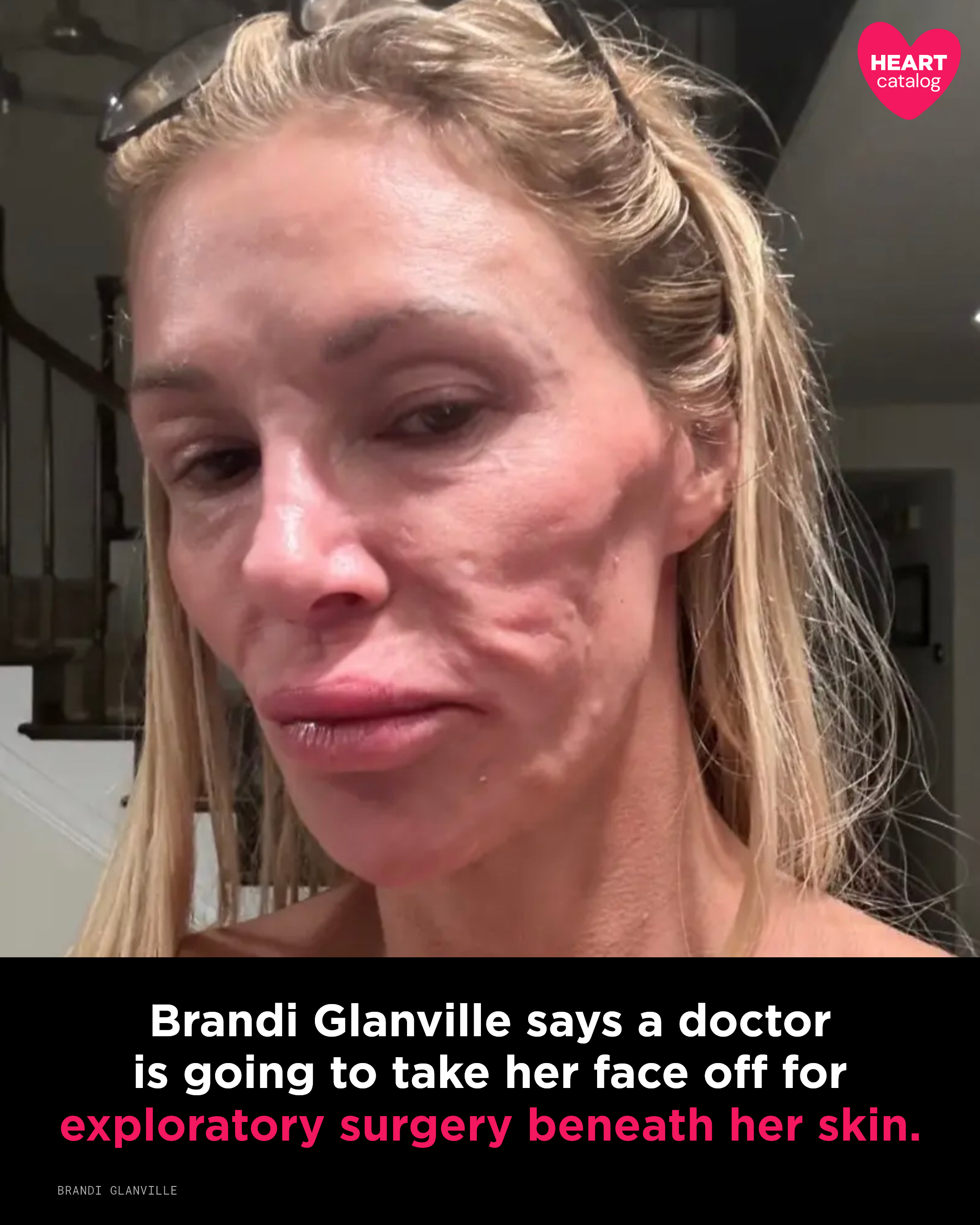 Brandi Glanville